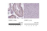 Immunohistochemistry analysis in human testis and liver tissues using HPA021367 antibody. Corresponding IGF2BP1 RNA-seq data are presented for the same tissues.