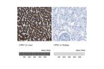 Immunohistochemistry analysis in human liver and kidney tissues using HPA021400 antibody. Corresponding CPS1 RNA-seq data are presented for the same tissues.