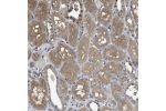 Immunohistochemical staining of human kidney shows moderate cytoplasmic positivity in renal tubules.