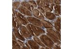Immunohistochemical staining of human skeletal muscle shows strong cytoplasmic positivity in myocytes.