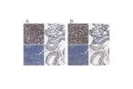 Immunohistochemistry analysis in human liver and pancreas tissues using Anti-HSD17B4 antibody. Corresponding HSD17B4 RNA-seq data are presented for the same tissues.