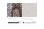 Immunohistochemistry analysis in human appendix and cerebral cortex tissues using Anti-PRKD2 antibody. Corresponding PRKD2 RNA-seq data are presented for the same tissues.