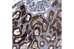 Immunohistochemical staining of human kidney shows strong granular cytoplasmic positivity in cells in tubules, while glomeruli are negative.