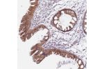 Immunohistochemical staining of human colon shows distinct membranous and cytoplasmic positivity in glandular cells.