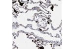 Immunohistochemical staining of human lung shows very strong granular positivity in cytoplasm in macrophages.