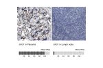 Immunohistochemistry analysis in human placenta and lymph node tissues using HPA021555 antibody. Corresponding JAG1 RNA-seq data are presented for the same tissues.