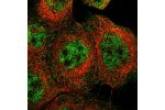 Immunofluorescent staining of human cell line A-431 shows localization to nucleoplasm & cytosol.