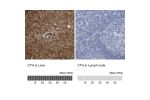 Immunohistochemistry analysis in human liver and lymph node tissues using Anti-CTH antibody. Corresponding CTH RNA-seq data are presented for the same tissues.