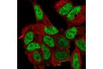 Immunofluorescent staining of human cell line SH-SY5Y shows localization to nucleoplasm.