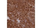 Immunohistochemical staining of human pancreas shows strong cytoplasmic positivity in exocrine glandular cells.
