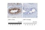 Immunohistochemistry analysis in human testis and prostate tissues using HPA021649 antibody. Corresponding DNAI1 RNA-seq data are presented for the same tissues.