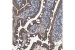 Immunohistochemical staining of human duodenum shows moderate cytoplasmic positivity in glandular cells.