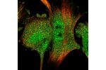 Immunofluorescent staining of human cell line U-251 MG shows localization to nucleoplasm & cytosol.