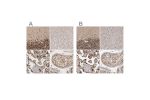 Immunohistochemical staining of human cerebellum, liver, placenta and testis using Anti-CBLL1 antibody HPA021773 (A) shows similar protein distribution across tissues to independent antibody HPA026699 (B).