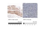 Immunohistochemistry analysis in human heart muscle and pancreas tissues using HPA021798 antibody. Corresponding SIRT5 RNA-seq data are presented for the same tissues.