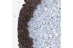 Immunohistochemical staining of human urinary bladder shows strong cytoplasmic positivity in urothelial cells.