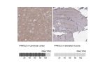 Immunohistochemistry analysis in human cerebral cortex and skeletal muscle tissues using HPA021851 antibody. Corresponding PRKCZ RNA-seq data are presented for the same tissues.