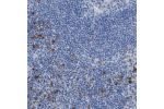Immunohistochemical staining of human lymph node shows moderate to strong membranous positivity in non-germinal center cells.