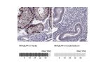 Immunohistochemistry analysis in human testis and endometrium tissues using HPA021942 antibody. Corresponding MAGEA4 RNA-seq data are presented for the same tissues.