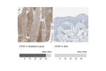 Immunohistochemistry analysis in human skeletal muscle and skin tissues using HPA021945 antibody. Corresponding DYSF RNA-seq data are presented for the same tissues.
