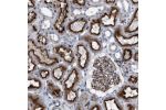 Immunohistochemical staining of human kidney shows strong membranous positivity in cells in tubules.