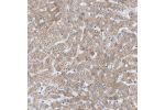 Immunohistochemical staining of human liver shows moderate cytoplasmic positivity in hepatocytes.