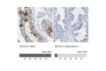 Immunohistochemistry analysis in human testis and endometrium tissues using Anti-TACC3 antibody. Corresponding TACC3 RNA-seq data are presented for the same tissues.