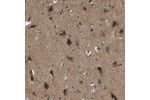 Immunohistochemical staining of human cerebral cortex shows strong cytoplasmic positivity in neuronal cells.