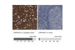 Immunohistochemistry analysis in human cerebral cortex and tonsil tissues using HPA022144 antibody. Corresponding ATP6V0A1 RNA-seq data are presented for the same tissues.