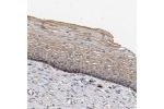 Immunohistochemical staining of human cervix, uterine shows moderate to strong cytoplasmic positivity in squamous epithelial cells.
