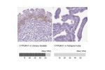 Immunohistochemistry analysis in human urinary bladder and fallopian tube tissues using HPA022261 antibody. Corresponding CYP24A1 RNA-seq data are presented for the same tissues.
