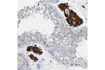 Immunohistochemical staining of human testis shows strong cytoplasmic positivity in Leydig cells.
