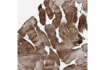 Immunohistochemical staining of human skeletal muscle shows strong cytoplasmic positivity in myocytes.