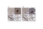 Immunohistochemical staining of human kidney, pancreas, prostate and testis using Anti-ACLY antibody HPA022434 (A) shows similar protein distribution across tissues to independent antibody HPA022953 (B).