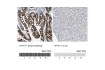 Immunohistochemistry analysis in human small intestine and liver tissues using HPA022483 antibody. Corresponding TPH1 RNA-seq data are presented for the same tissues.