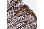 Immunohistochemical staining of human rectum shows strong nuclear and cytoplasmic positivity in glandular cells.