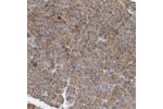 Immunohistochemical staining of human pancreas shows moderate cytoplasmic positivity in exocrine glandular cells.