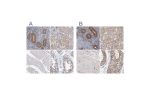 Immunohistochemistry analysis in human lymph node and skeletal muscle tissues using HPA022886 antibody. Corresponding PFAS RNA-seq data are presented for the same tissues.