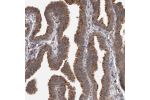 Immunohistochemical staining of human fallopian tube shows strong cytoplasmic positivity in glandular cells.