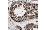 Immunohistochemical staining of human pancreas shows strong nuclear and slightly weaker nuclear positivity in exocrine as well as endocrine cells.