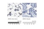 Immunohistochemistry analysis in human bone marrow and placenta tissues using Anti-MMP8 antibody. Corresponding MMP8 RNA-seq data are presented for the same tissues.