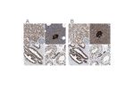 Immunohistochemical staining of human kidney, pancreas, prostate and testis using Anti-ACLY antibody HPA022953 (A) shows similar protein distribution across tissues to independent antibody HPA022434 (B).