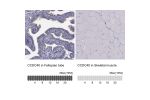 Immunohistochemistry analysis in human fallopian tube and skeletal muscle tissues using Anti-CCDC40 antibody. Corresponding CCDC40 RNA-seq data are presented for the same tissues.