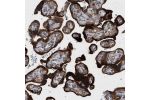Immunohistochemical staining of human placenta shows strong cytoplasmic positivity in trophoblastic cells.