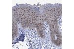Immunohistochemical staining of human skin shows moderate nuclear positivity in epidermal cells.
