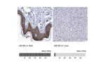 Immunohistochemistry analysis in human skin and liver tissues using HPA023013 antibody. Corresponding BICD2 RNA-seq data are presented for the same tissues.
