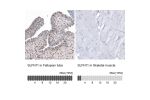 Immunohistochemistry analysis in human fallopian tube and skeletal muscle tissues using HPA023030 antibody. Corresponding SLFN11 RNA-seq data are presented for the same tissues.