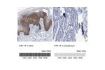 Immunohistochemistry analysis in human skin and duodenum tissues using Anti-KRT14 antibody. Corresponding KRT14 RNA-seq data are presented for the same tissues.