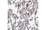 Immunohistochemical staining of human lung shows strong cytoplasmic positivity in macrophages.