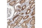 Immunohistochemical staining of human kidney shows strong cytoplasmic positivity in cells in tubules.